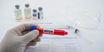 Nieuwe clade 1b-variant ontdekt in Frankrijk: alarmfase ingegaan.