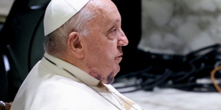 Paus Franciscus over complexe klinische toestanden in de gezondheidszorg