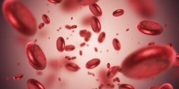 Diagnose en behandeling van zeldzame bloedkanker: amyloïdose en neoplasmata