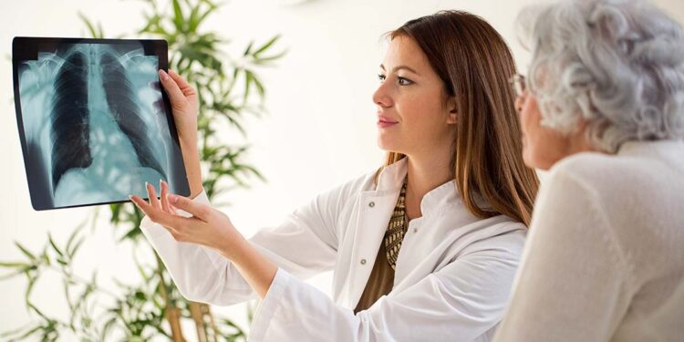 Longkanker: dodelijkste ziekte ter wereld