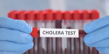 Cholera-uitbraak eist 31 levens in Ethiopië, verspreiding naar westen.