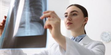 Tuberculose bij kinderen stijgt met 10% in Europa