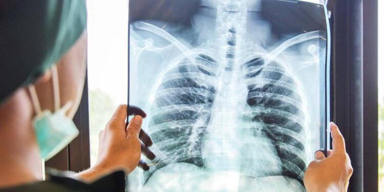 Wereldtuberculosedag: evenement georganiseerd door de Hellenic Pulmonary Society