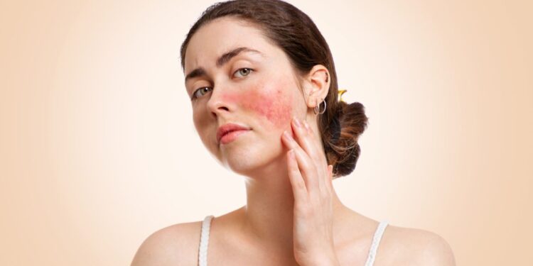 Bescherm je huid: tips van de Hellenic Dermatological Society