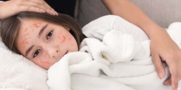 Nieuws: 22 gevallen van toename in Mexico aangekondigd