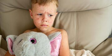 Bezuinigingen op Amerikaanse hulp kosten miljoenen mensenlevens