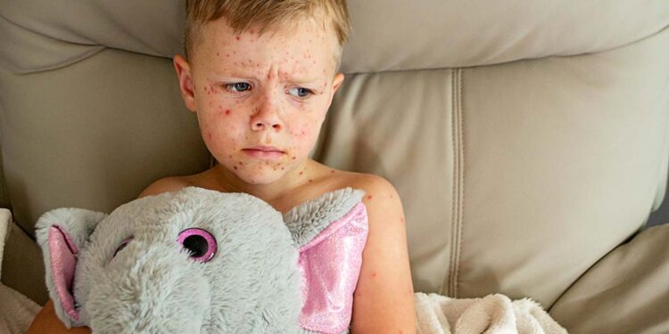 Bezuinigingen op Amerikaanse hulp kosten miljoenen mensenlevens