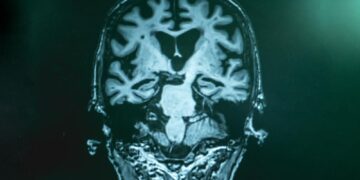 Cellen herdefiniëren voor gewaseliminatie