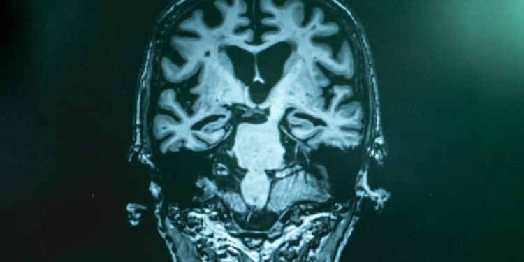 Cellen herdefiniëren voor gewaseliminatie