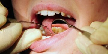 MPs: Schema voor toegang tot tandartsen NHS “volledig mislukt”