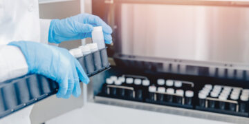 Medisch schandaal: spermadonoren hebben maximaal 75 kinderen