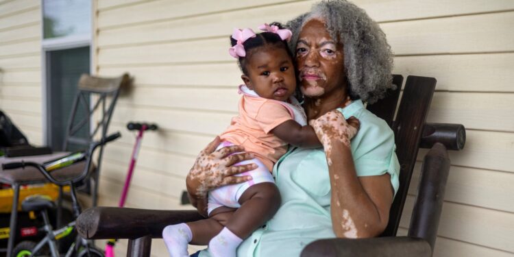 Milieurechtvaardigheid in de VS: prijs voor minderheidsgemeenschappen