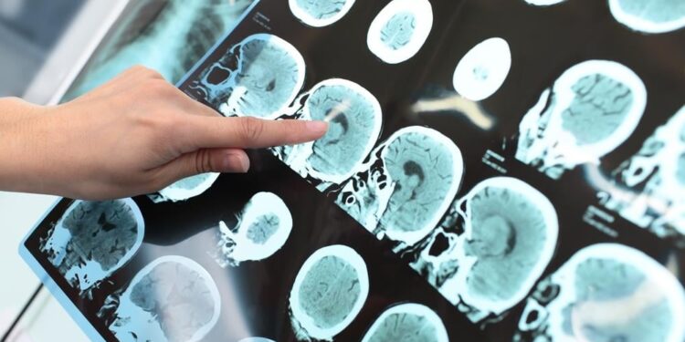 Op zoek naar de oorsprong van ons bewustzijn