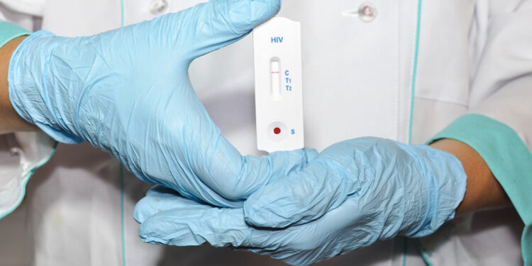 Gratis examens voor seksuele ziekten – ontdek waar en wanneer!