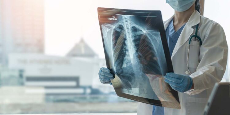 Nieuwe digitale vragenlijst ‘Lungx’ voor gezondheid van de long.