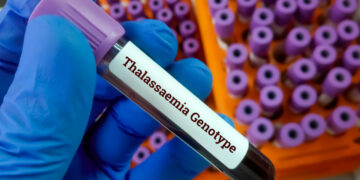 Thalassemie: een eerbetoon aan moedige strijders