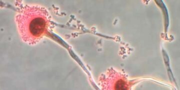 Wetenschappers waarschuwen voor dodelijke schimmels die ons van binnenuit opeten