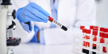 Doorbraak: Alzheimer diagnose met bloedtest goedgekeurd in de VS