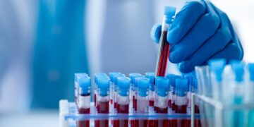 Verbazing en kritiek op uitspraken Tsjechische vice-minister van Volksgezondheid