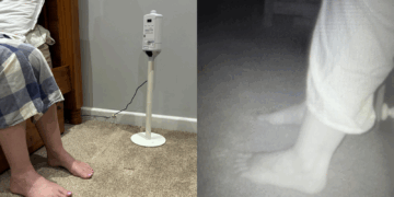 AI voet scanner detecteert waarschuwingssignalen hartfalen om ziekenhuisopname te voorkomen