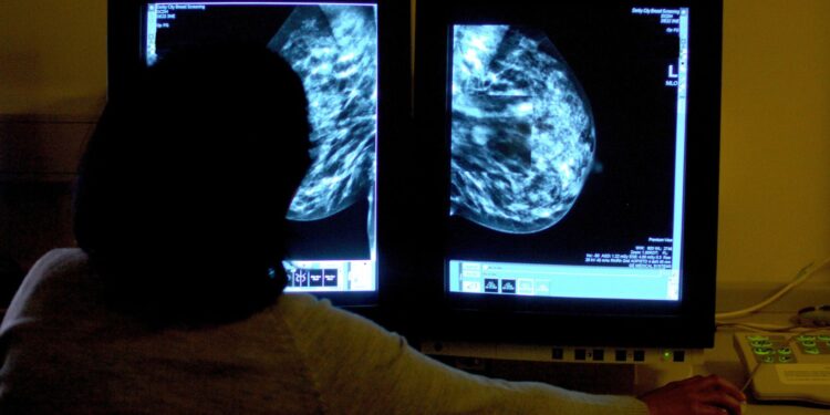 Nieuwe medicatie voorkomt groei van borstkankertumoren, blijkt uit onderzoek.