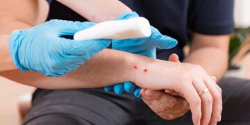 Viperbeet op Evia: 40 jaar intensief onderzoek