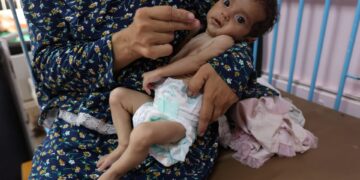 Kwartaal van kinderen tot 5 jaar ondervoed in Gaza, artsen zonder grenzen alarm.