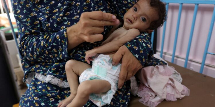 25% van kinderen in Gaza ondervoed, PM belooft evacuatie medische gevallen