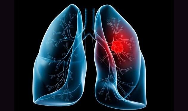 Doorbraak: Mensen ontvangen succesvolle longtransplantatie van varkens.