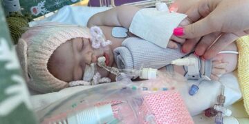 Wetenschappers prijzen revolutionaire behandeling voor zeldzame aandoening bij baby’s.