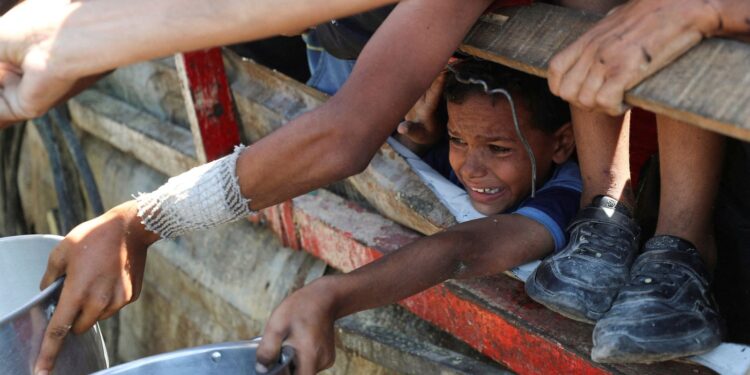 Meer kinderen uit Gaza naar VK voor medische behandeling.