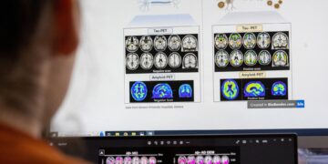 Vroegtijdige detectie Alzheimer met eenvoudig huishoudonderzoek