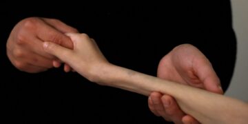 Kinderen uit Gazastrook naar VK voor medische behandeling