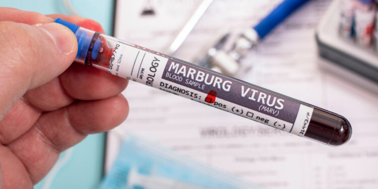 Ethiopië waarschuwt voor dodelijk Marburg-virus