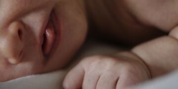 ‘Schotland introduceert eenvoudige genetische test om doofheid bij baby’s te voorkomen’