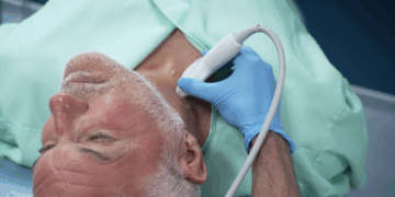 Eenvoudige nekscan detecteert risico hartinfarct en beroerte