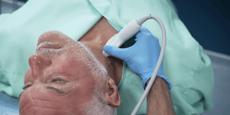 Eenvoudige nekscan detecteert risico hartinfarct en beroerte