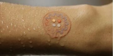 Kunstmatige intelligentie detecteert ziektes via zweetanalyse