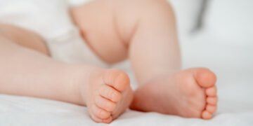 Unieke intra-uteriene behandeling redt foetus met zeldzame vasculaire tumor