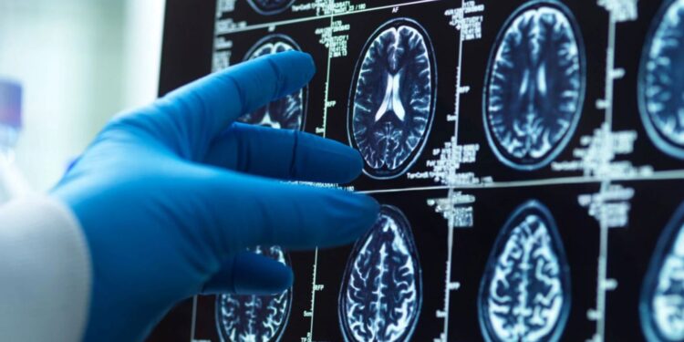 Ontdekking biedt hoop voor kinderen met zeldzame epilepsie.