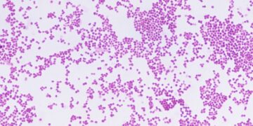 Meningitis-uitbraak in Kent waarschuwt jongeren voor risico’s