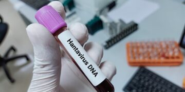 25-jarige op dezelfde vlucht als hantaviruspatiënt vertoont symptomen