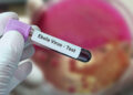 Mogelijk Ebola-geval ontdekt in Sao Paulo, Brazilië