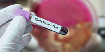 Mogelijk Ebola-geval ontdekt in Sao Paulo, Brazilië