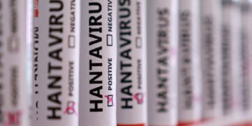 Vermoedelijk geval van hantavirus vastgesteld in Spanje