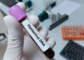 Passagier MV Hondius in Spanje test positief op hepatitis