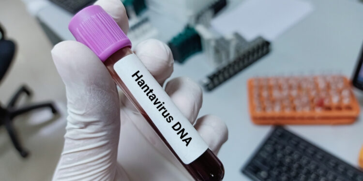 Passagier MV Hondius in Spanje test positief op hepatitis