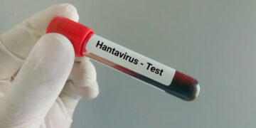 Hantavirus uitbraak stijgt tot 13 gevallen op cruiseschip MV Hondius